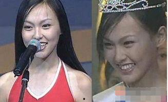 龅牙娱乐吃瓜,揭秘娱乐圈吃瓜背后的真相与笑料